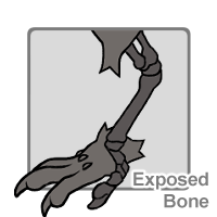 Exposed Bone